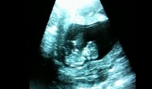 ¡INCREÍBLE VIDEO! UN BEBE DE TAN SOLO  12 SEMANAS JUEGA EN EL VIENTRE DE SU MADRE