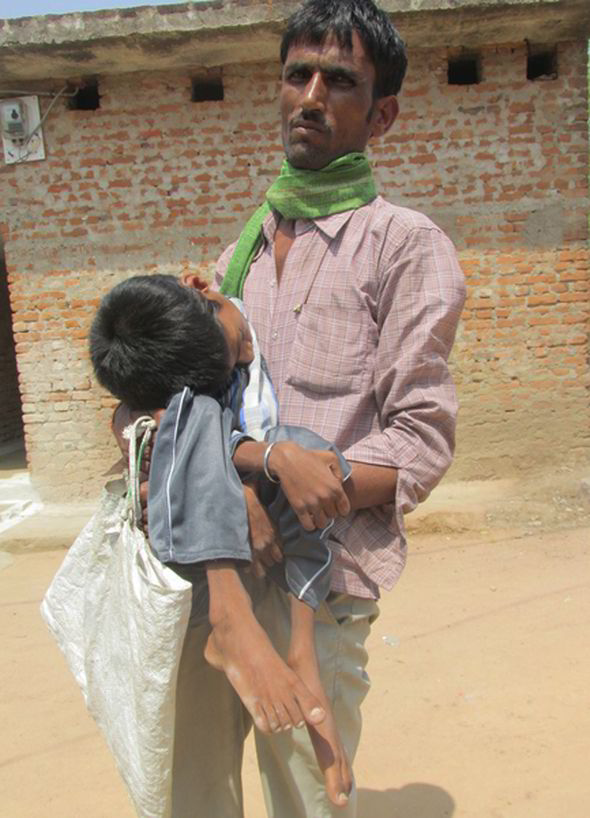 Mahendra-Ahirwar-boy-born-upside-down-head-277798