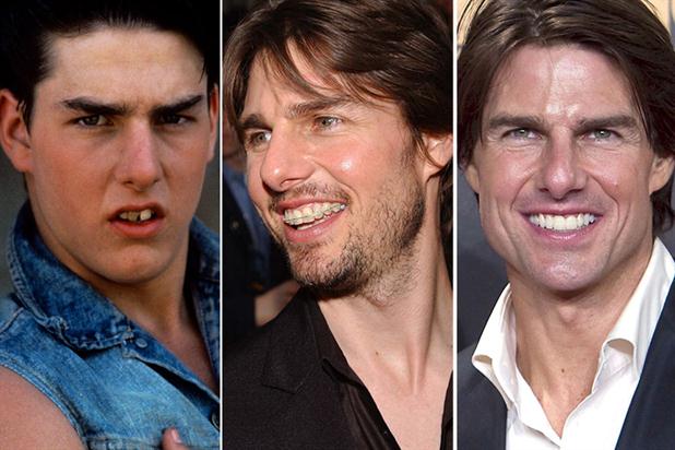 tom-cruise-carillas