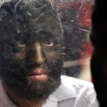 La maldición de la "familia lobo".  La familia más peluda del mundo revelan cómo han luchado para sobrevivir la intimidación, el envenenamiento y la persecución por ser tildados de bestias satánicas