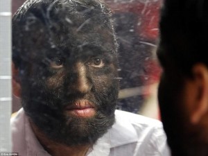 La maldición de la «familia lobo».  La familia más peluda del mundo revelan cómo han luchado para sobrevivir la intimidación, el envenenamiento y la persecución por ser tildados de bestias satánicas