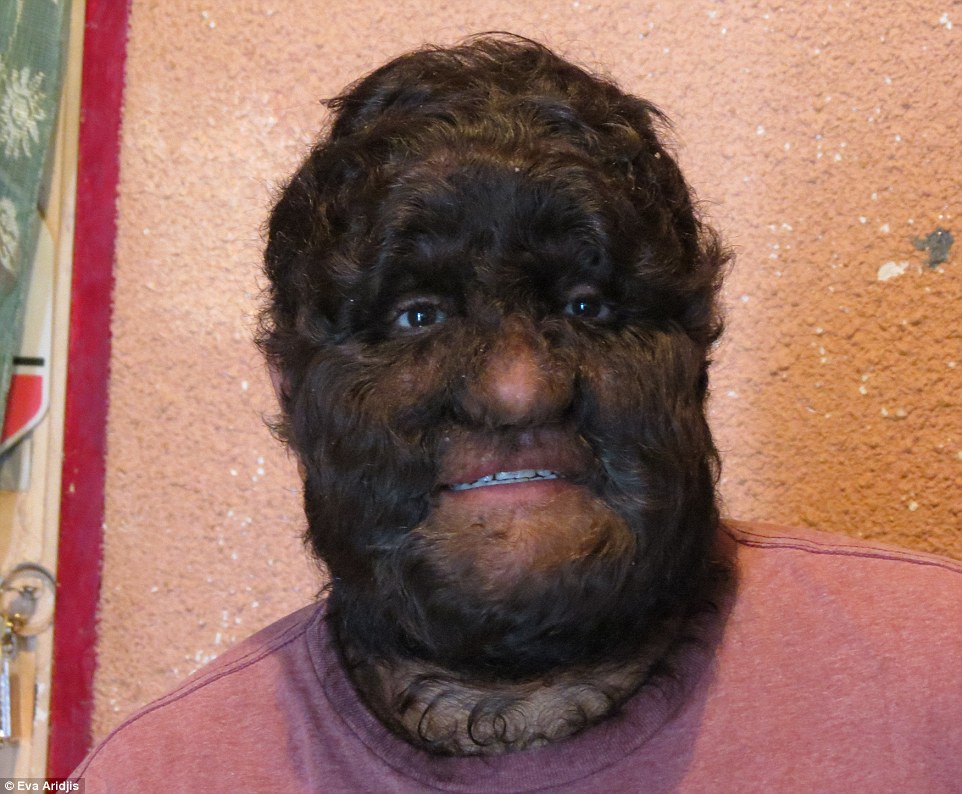 2BEDAAB300000578-3220688-Content_Chuy_s_particularly_hairy_brother_Danny_says_the_hair_wh-a-79_1441279162848 (1)