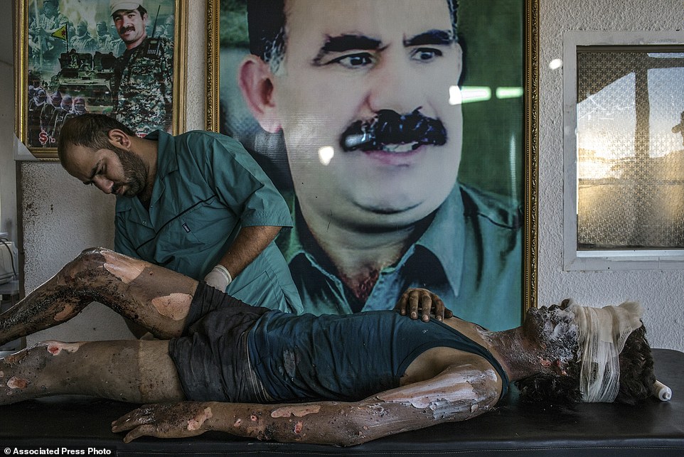 In this image released by World Press Photo titled "IS Fighter Treated at Kurdish Hospital" by photographer Mauricio Lima for The New York Times which won a first prize in the General News singles category shows a doctor rubbing ointment on the burns of a 16-year-old Islamic State fighter named Jacob in front of a poster of Abdullah Ocalan, the jailed leader of the Kurdistan Workers' Party, at a Y.P.G. hospital compound on the outskirts of Hasaka, Syria, August 1, 2015. (Mauricio Lima/The New YorkTimes, World Press Photo via AP)